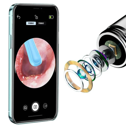 Wireless Ear Cleaner with Camera & LED Light โ Smart Ear Wax Removal Tool